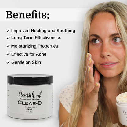 Nourish-d "CLEAR-D" – Clarifying Skincare for Acne-Prone Skin